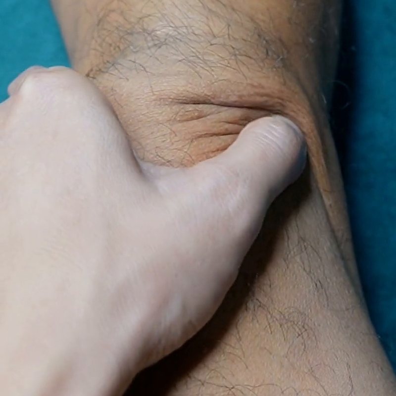 A thumb pressing gently into the crease above the kneecap