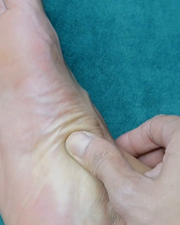A thumb pressing the inner edge of a bare foot, in front of the heel