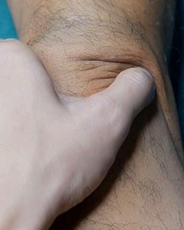 A thumb pressing gently into the crease right above the kneecap