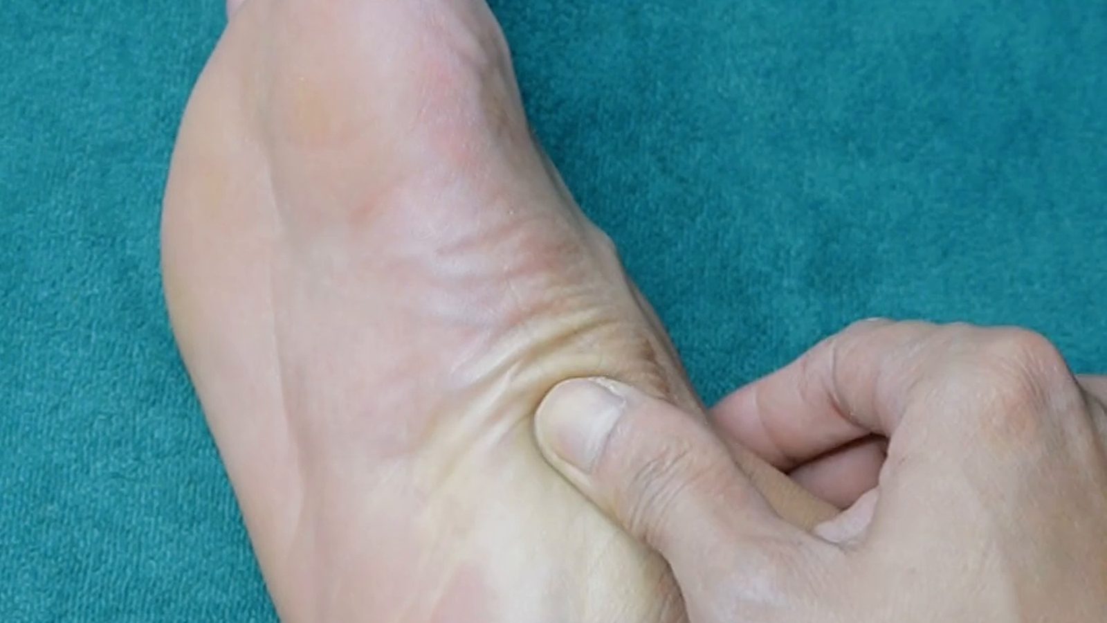 A thumb pressing the inner edge of a bare foot resting on a teal towel