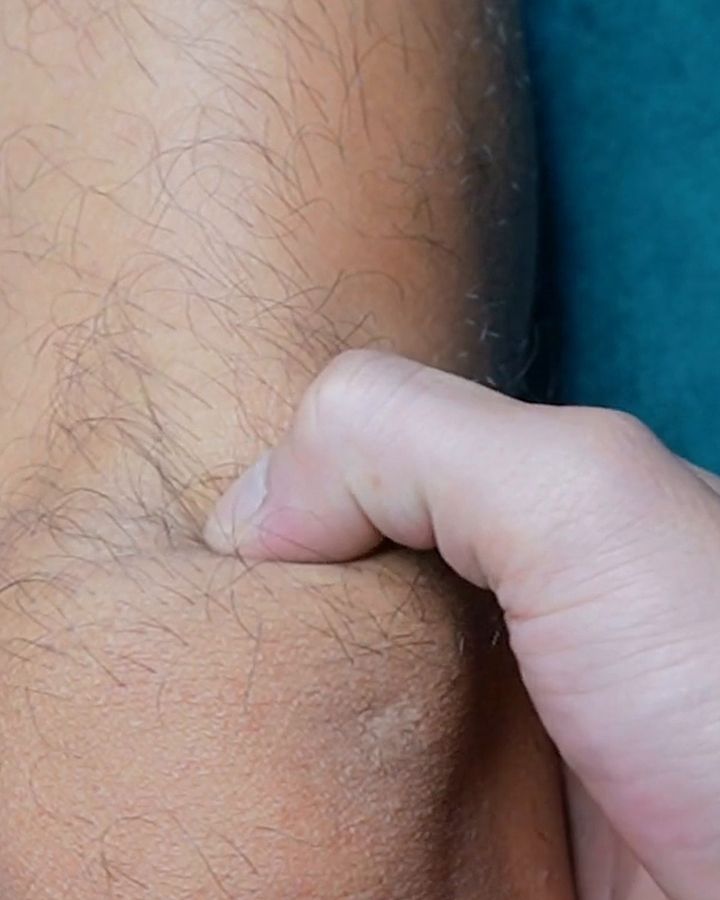 A thumb pressing into the soft hollow at the edge of the kneecap