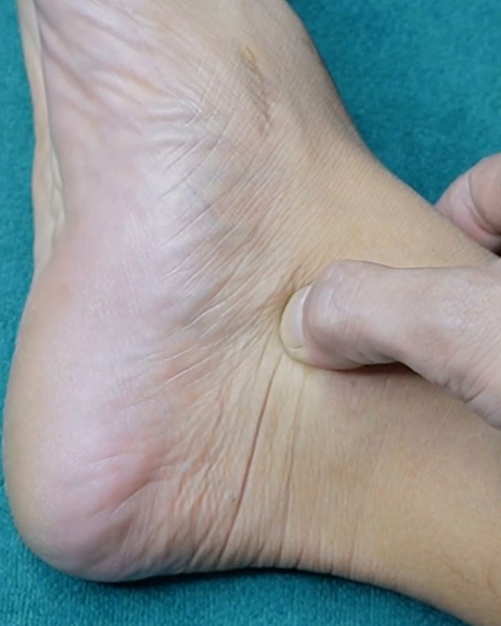 A thumb pressing right below the inner ankle bone of a bare foot resting on a teal towel